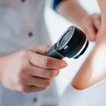 Udruženja pacijenata sa hematološkim malignitetima: Dostupnost inovativne terapije u ranim fazama bolesti ključna