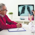 Kontrola život znači! Rano otkrivanja raka pluća daje veće šanse za izlečenje