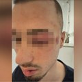 Ispovest majke maloletnika kog je pretukla grupa tinejdžera: Policija pustila osumnjičenog, Hitna pomoć ga sa teškim povredama…