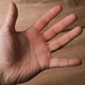 Tokom vrućina telo neprimetno gubi vodu: Jednostavan test sa kožom pomaže da prepoznate problem