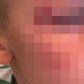 "Samo ga je gurnuo niz stepenice, bez ikakvog povoda": Jezivo nasilje u školi u Šapcu, oglasila se majka
