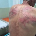 Ovo je dokaz i priznanje da su Kurtijevi policajci tukli i zlostavljali Nenada Raškovića