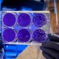 SZO upozorila na nagli porast otpornosti na antibiotike