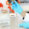 Provera holesterola i triglicerida u subotu u Domu zdravlja bez uputa i zakazivanja