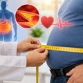 Salo na stomaku nosi najveći rizik: Đinđić upozorava zašto obim struka nije samo estetsko pitanje