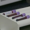 Studija: Test krvi bi mogao da otkrije 50 asimptomatskih vrsta raka