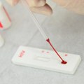 Testiranje na HIV besplatno i bez zakazivanje u utorak u Nišu