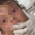Noćna mora za roditelje: Pogledajte šta su lekari izvukli ovom uplašenom dečaku iz uha