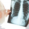 Veliki napredak u lečenju plućne hipertenzije: Nove terapije dostupne u Srbiji