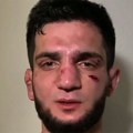 Nestvarna vest: MMA borac pao sa desetog sprata, dan kasnije se probudio iz kome