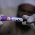 Svetu preti ponovno širenje epidemije HIV-a