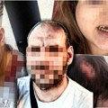 "Tužiteljka u svojoj karijeri nije imala teži slučaj od mog" Produžen pritvor nasilniku koji je na Kanaervom brdu zverski…