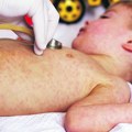 "Pozitivan je!" – Dete zarazilo hiljade? Haos na Svetskoj izložbi