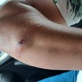 U Priboju otac i sin brutalno pretukli aktivistu naprednjaka