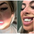 „Sviđaju mi se moji turski zubi, iako ljudi kažu da su najgori koje su videli“