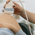 Zatrudnela pa se na prvom pregledu šokirala Ovo se dešava jednom u 100.000 slučajeva