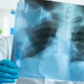 Nevidljiva pretnja po pluća Naučnici su pronašli zabrinjavajući materijal u ljudskom telu