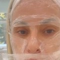 Ставили јој фолију преко целог лица: Удовица певача се снимала пред интервенцију: "Скинуће ми израслину"