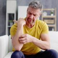 Naučnici došli do iznenađujućeg otkrića: Svrab možda ima sopstveni čulni organ