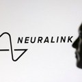 Muskov Neuralink prikupio 650 miliona dolara, počinju klinička ispitivanja