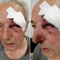 Uhapšen muškarac koji je pretukao generala u penziji! Napad na stanici u Beogradu