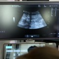 Na skriningu trbušne aorte u 3 grada otkriveno 30 aneurizmi: Pregledi se nastavljaju u Beogradu