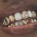 How It Started, How It’s Going: Grillz