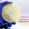 Zabrinjavajući podaci: SZO upozorava na sve veću pretnju