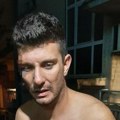 Uznemirujuće fotografije pretučenog Stefana Mihića: Bivši učesnik Zadruge sav u podlivima, polomljena mu rebra