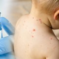 MMR vakcinu u prošloj godini primilo skoro 85 odsto dece: „To je nedovoljno, za kolektivni imunitet potrebno bar 95…