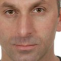 Gordanu je zbog kancera amputiran nos, za 3 meseca imao je tri operacije: Mora da nastavi lečenje