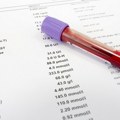 Analiza krvi mogla bi da predvidi stepen rizika od najčešćeg oboljenja srca