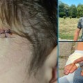 PAS UJEO TROGODIŠNJEG DEČAKA U ČAIRU, POVREDIO I OCA DOK JE BRANIO SINA: „Sve se dogodilo za nekoliko sekundi“