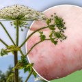 Pipneš je i mesecima imaš ožiljke! Borba protiv veoma invazivne i otrovne biljke u okolini Beograda još nije gotova, oglasilo…