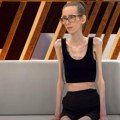 Jela 5 breskvi i malo sira svaki dan da bi smršala: Anastasija sada ima samo 29 kilograma i život joj je borba