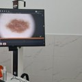 UKC Kragujevac dobio najsavremeniji sistem za digitalni pregled kože