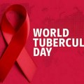 Svetski dan borbe protiv tuberkuloze; U Srbiji prošle godine registrovano 410 obolelih