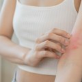 Beograd domaćin najvećih svetskih imena dermatologije