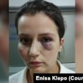 Gazda hotela u BiH pred sudom tvrdi da nije pretukao recepcionerku