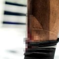 Uznemirujuće! Jeziva povreda Sadika, ovako nešto se ne pamti, publika nemo posmatrala
