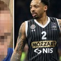 Uznemirujuće! Ovako izgleda momak kome je Karlik Džons slomio flašu o glavu: Lice mu je unakaženo