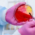 Bakterija gonoreje sve otpornija na lekove: Protiv tripera skoro da više ni antibiotici ne pomažu