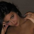 Kylie Jenner priznala šta je radila od estetskih tretmana