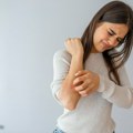 Najsavremenijim terapijama dostupnim o trošku RFZO moguće je držati psorijazu pod kontrolom