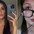 Anja Bla "pre i posle": Baka Prase kaže da je uzimala steroide, a pogledajte kako je nekad izgledala zgodna influenserka