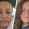 "Normalan dan bio mi je povraćanje krvi koju bih isprala viskijem": Nakon smrti roditelja Ema se odala poroku, a onda je život…