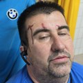 Priča pretučenog Jovice iz Valjeva: „Došli d’ubiju“