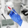 BioNTech zatvara fabrike i razvija lekove protiv raka