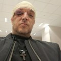 Zoran Marjanović pretučen zbog ove žene! Zajedno došli u stan na Paliluli, pa nastao karambol: Ljubav ga skupo koštala! Novi…