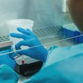 Institut "Milan Jovanović Batut": U Srbiji zabeleženo 46 slučajeva groznice Zapadnog Nila